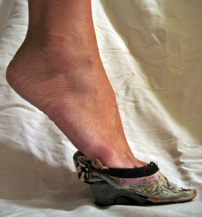 Нормальная ступня и туфли-лотоса
